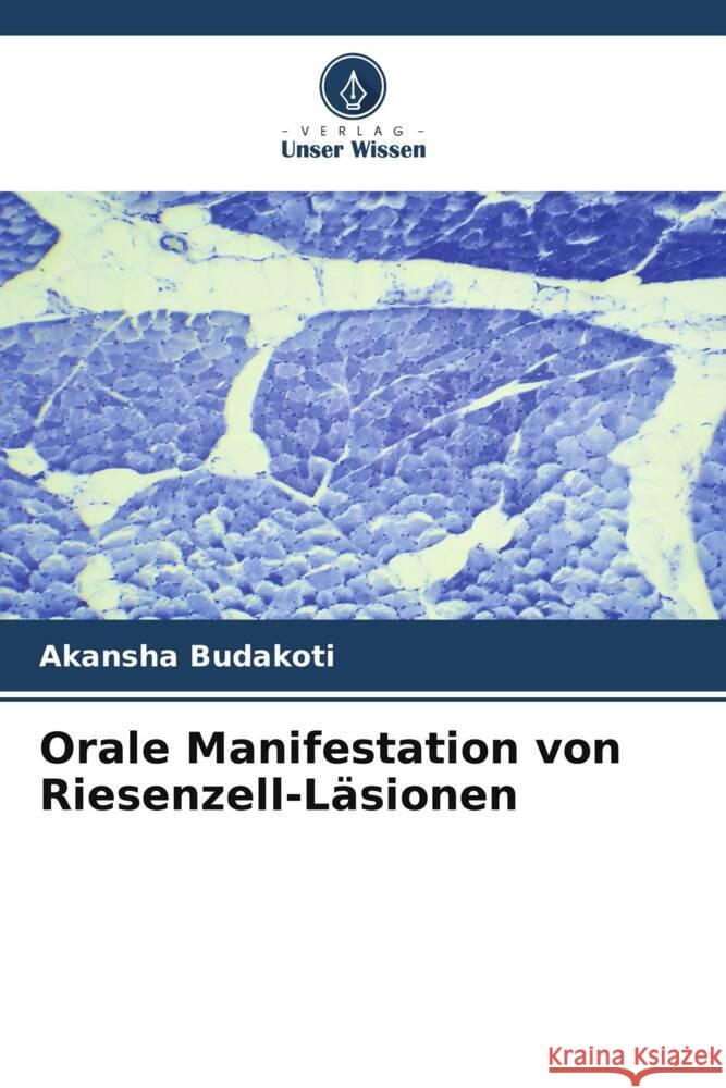 Orale Manifestation von Riesenzell-Läsionen Budakoti, Akansha 9786205059791 Verlag Unser Wissen - książka