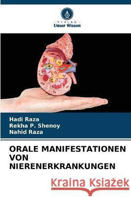 Orale Manifestationen Von Nierenerkrankungen Hadi Raza Rekha P Shenoy Nahid Raza 9786205651216 Verlag Unser Wissen - książka