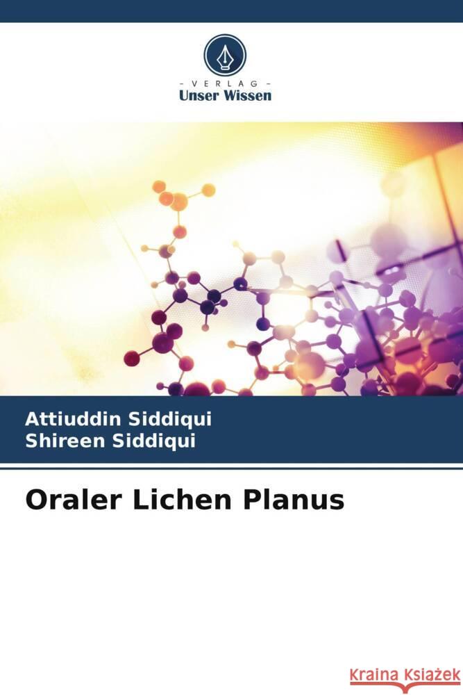 Oraler Lichen Planus Siddiqui, Attiuddin, Siddiqui, Shireen 9786204812281 Verlag Unser Wissen - książka