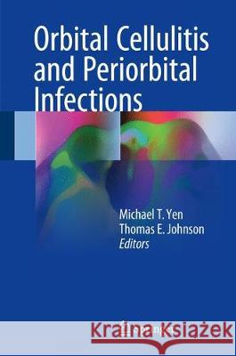 Orbital Cellulitis and Periorbital Infections Michael T. Yen Thomas E. Johnson 9783319626055 Springer - książka