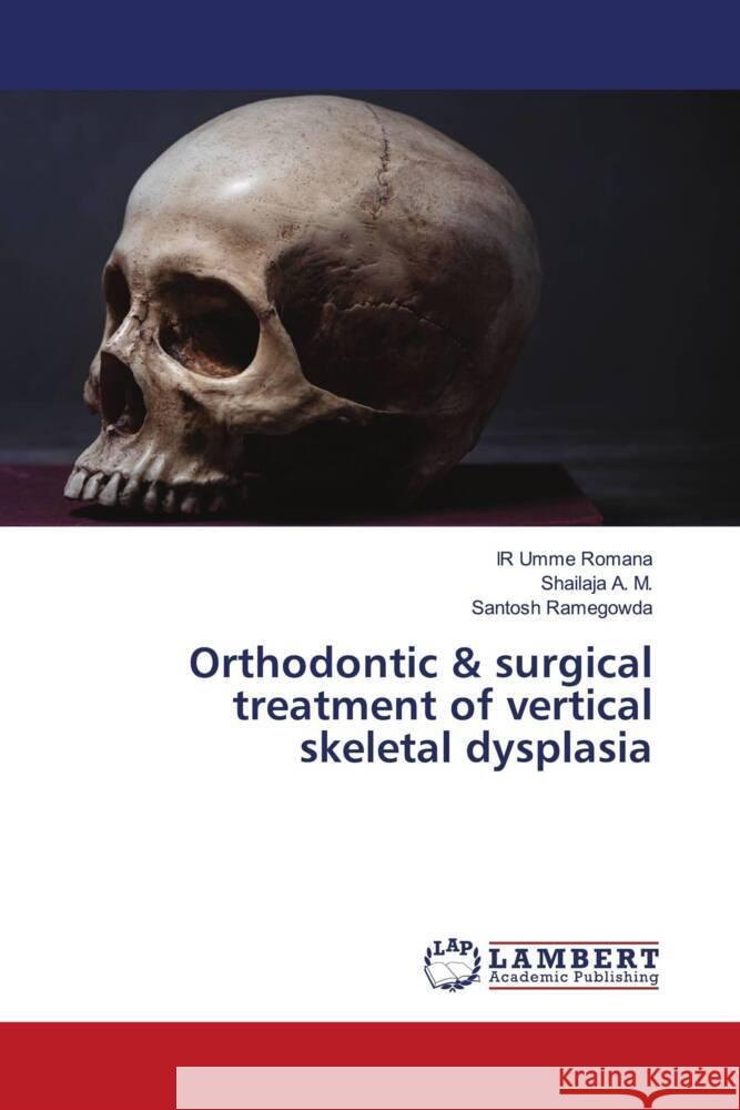 Orthodontic & surgical treatment of vertical skeletal dysplasia Romana, IR Umme, A. M., Shailaja, Ramegowda, Santosh 9786202919142 LAP Lambert Academic Publishing - książka