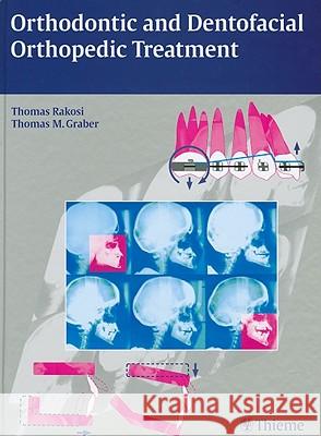 Orthodontic and Dentofacial Orthopedic Treatment Graber 9783131277619 Thieme Medical Publishers - książka