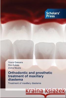 Orthodontic and prosthetic treatment of maxillary diastema Yosra Gassara Rim Kallala Zohra Nouira 9786206773603 Scholars' Press - książka