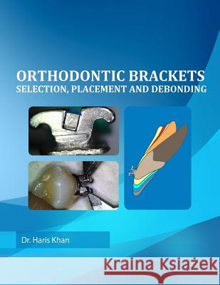 Orthodontic Brackets: Selection, Placement and Debonding Dr Haris Khan 9781508936275 Createspace - książka