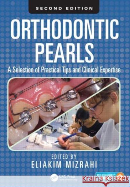 Orthodontic Pearls: A Selection of Practical Tips and Clinical Expertise, Second Edition Eliakim Mizrahi 9781482241945 CRC Press - książka