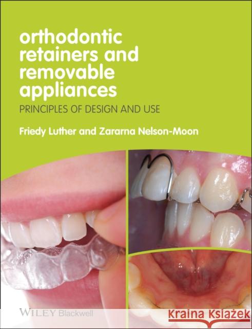 Orthodontic Retainers and Removable Appliances: Principles of Design and Use Luther, Friedy 9781444330083 Wiley-Blackwell (an imprint of John Wiley & S - książka