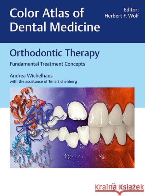 Orthodontic Therapy: Fundamental Treatment Concepts Wichelhaus, Andrea 9783132008519 Tps - książka