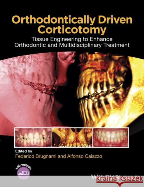 Orthodontically Driven Corticotomy: Tissue Engineering to Enhance Orthodontic and Multidisciplinary Treatment Brugnami, Federico 9781118486870 John Wiley & Sons - książka
