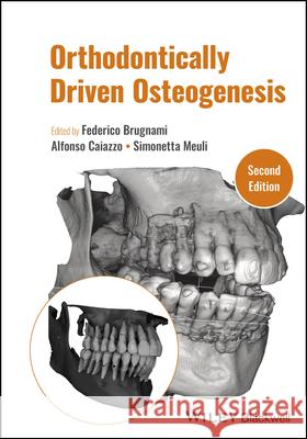 Orthodontically Driven Osteogenesis  9781119700562 Wiley - książka