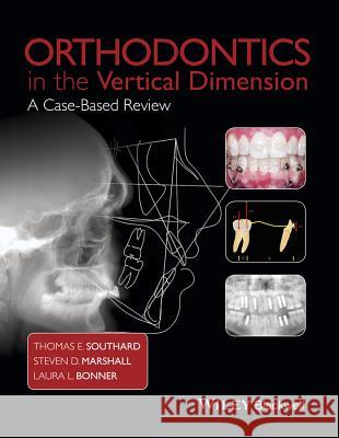 Orthodontics in the Vertical Dimension: A Case-Based Review Southard, Thomas E. 9781118870211 Wiley-Blackwell - książka