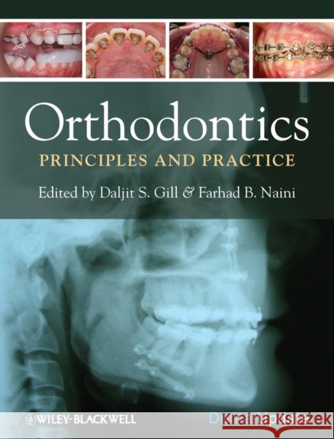 Orthodontics: Principles and Practice Naini, Farhad B. 9781405187473 John Wiley & Sons - książka