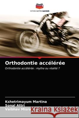 Orthodontie accélérée Martina, Kshetrimayum 9786203644937 Editions Notre Savoir - książka