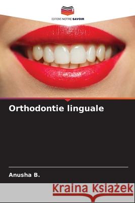 Orthodontie linguale Anusha B 9786202214094 Editions Notre Savoir - książka