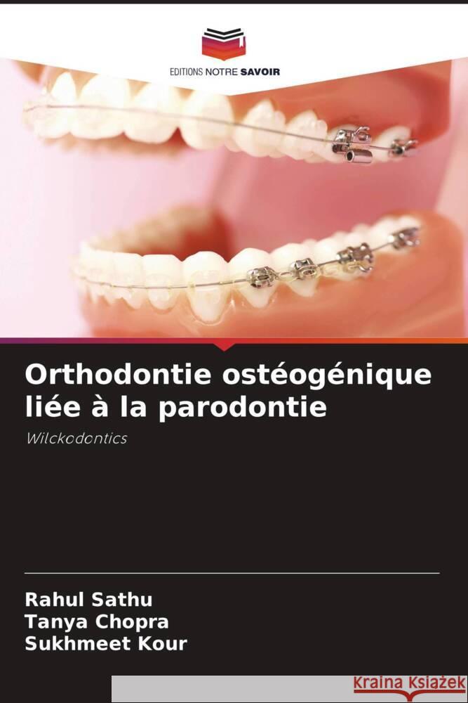 Orthodontie ostéogénique liée à la parodontie Sathu, Rahul, Chopra, Tanya, Kour, Sukhmeet 9786205245866 Editions Notre Savoir - książka