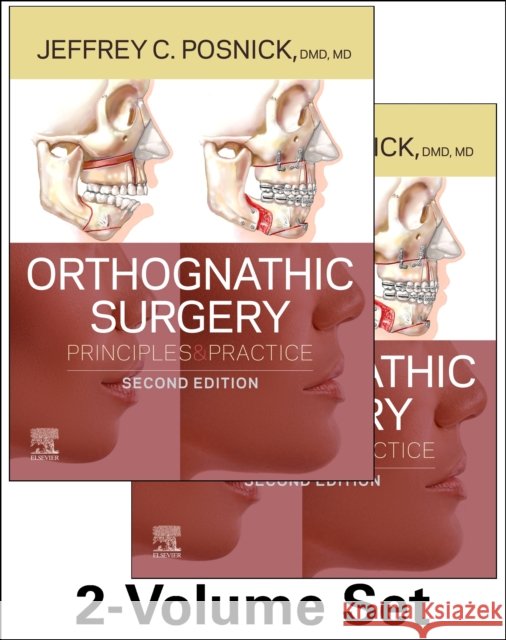 Orthognathic Surgery - 2 Volume Set: Principles and Practice Jeffrey C. Posnick 9780323791823 Saunders - książka