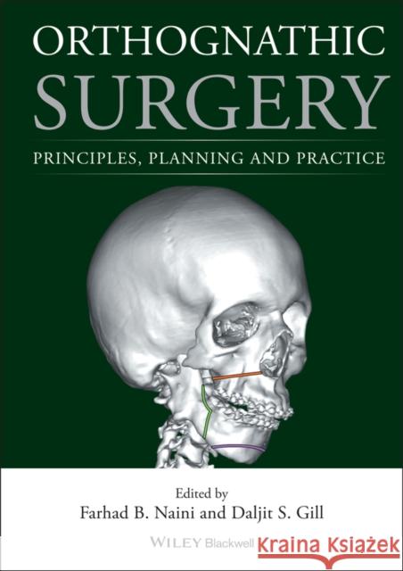 Orthognathic Surgery: Principles, Planning and Practice Naini, Farhad B. 9781118649978 John Wiley & Sons - książka