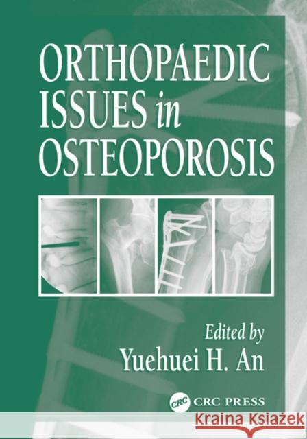 Orthopaedic Issues in Osteoporosis Yuehuei H. An 9780849310331 CRC Press - książka