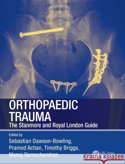 Orthopaedic Trauma: The Stanmore and Royal London Guide Dawson-Bowling, Sebastian 9781444148824 Hodder Arnold - książka