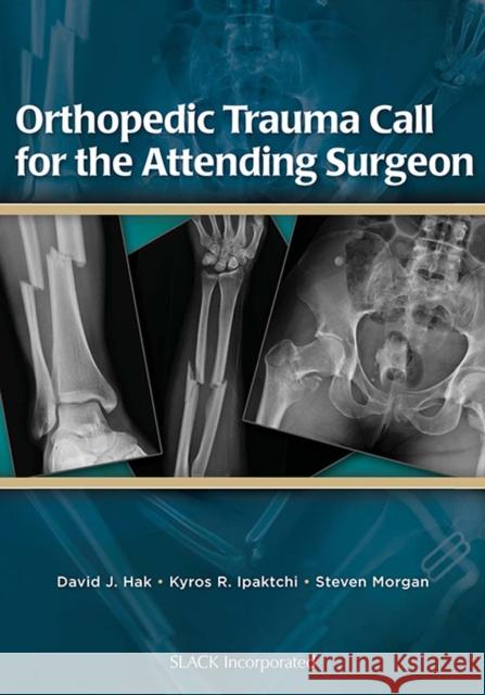 Orthopedic Trauma Call for the Attending Surgeon David J. Hak Kyros R. Ipaktchi Steven Morgan 9781556429927 Slack - książka