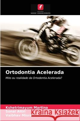 Ortodontia Acelerada Kshetrimayum Martina, Sonal Attri, Vaibhav Misra 9786203644982 Edicoes Nosso Conhecimento - książka