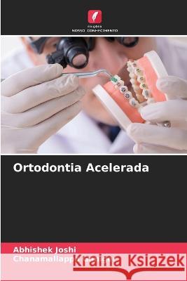 Ortodontia Acelerada Abhishek Joshi Chanamallappa Ganiger  9786205653791 Edicoes Nosso Conhecimento - książka