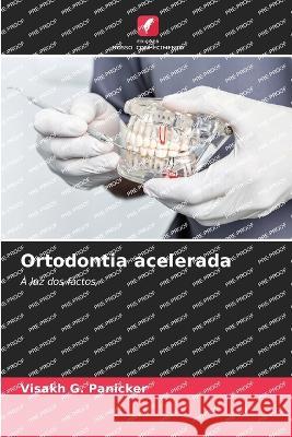 Ortodontia acelerada Visakh G Panicker   9786206090380 Edicoes Nosso Conhecimento - książka