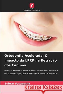 Ortodontia Acelerada: O Impacto da LPRF na Retra??o dos Caninos Subrat Satapathy 9783639865295 Edicoes Nosso Conhecimento - książka