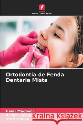 Ortodontia de Fenda Dent?ria Mista Umar Maqbool Achint Juneja Stuti Mohan 9786205727171 Edicoes Nosso Conhecimento - książka