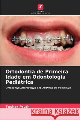 Ortodontia de Primeira Idade em Odontologia Pediátrica Tushar Pruthi, Monika Gupta, Inder Kumar Pandit 9786205341797 Edicoes Nosso Conhecimento - książka