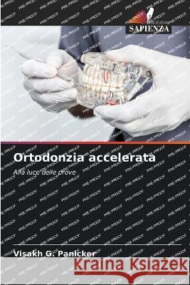 Ortodonzia accelerata Visakh G Panicker   9786206090427 Edizioni Sapienza - książka