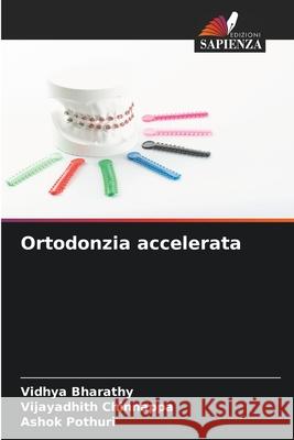 Ortodonzia accelerata Bharathy, Vidhya, Chinnappa, Vijayadhith, POTHURI, ASHOK 9786208856090 Edizioni Sapienza - książka