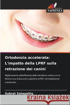 Ortodonzia accelerata: L'impatto della LPRF sulla retrazione dei canini SATAPATHY, SUBRAT 9783639865844 Edizioni Sapienza - książka