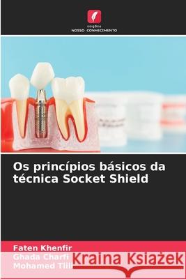 Os princípios básicos da técnica Socket Shield Khenfir, Faten, Charfi, Ghada, Tlili, Mohamed 9786209280207 Edições Nosso Conhecimento - książka