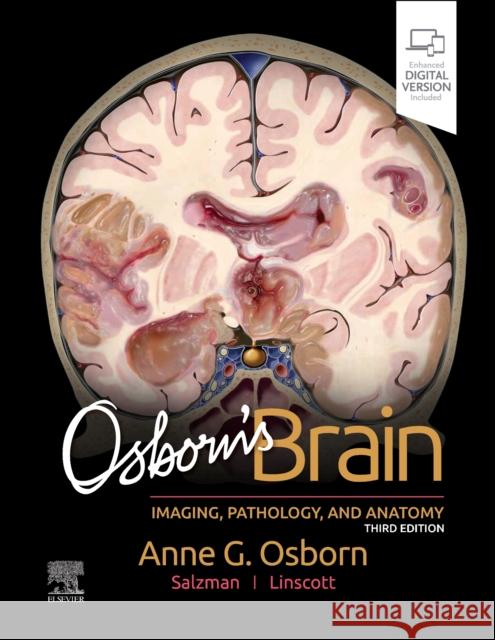 Osborn's Brain Karen L. (Professor of Radiology and Imaging Sciences, Neuroradiology Section Chief and Associate Fellowship Director, L 9780443109379 Elsevier Health Sciences - książka