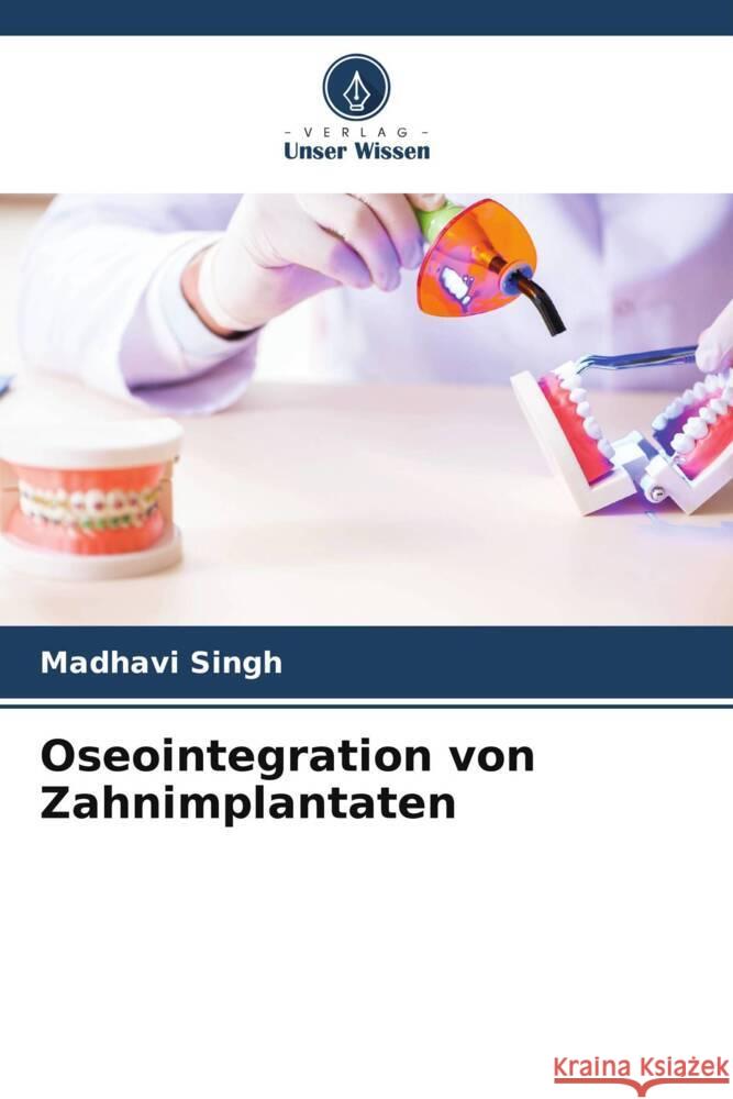 Oseointegration von Zahnimplantaten Singh, Madhavi 9786205253489 Verlag Unser Wissen - książka