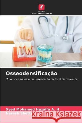 Osseodensificacao Syed Mohamed Huzaifa A H Naresh Shetty  9786206047933 Edicoes Nosso Conhecimento - książka