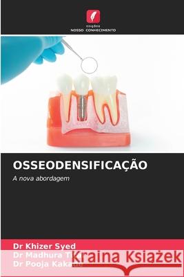 OSSEODENSIFICAÇÃO Syed, Dr Khizer, Titar, Dr Madhura, Kakade, Dr Pooja 9786200759214 Edições Nosso Conhecimento - książka