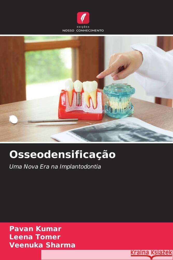 Osseodensificação Kumar, Pavan, Tomer, Leena, Sharma, Veenuka 9786205127315 Edições Nosso Conhecimento - książka