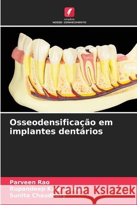 Osseodensificação em implantes dentários Rao, Parveen, Samra, Rupandeep Kaur, Chaudhary, Sunita 9786209397981 Edições Nosso Conhecimento - książka