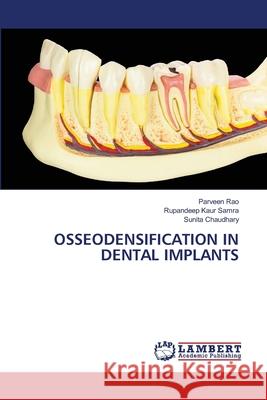 Osseodensification in Dental Implants Parveen Rao Rupandeep Kaur Samra Sunita Chaudhary 9786209275395 LAP Lambert Academic Publishing - książka