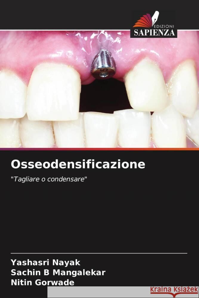 Osseodensificazione Yashasri Nayak Sachin B. Mangalekar Nitin Gorwade 9786206892946 Edizioni Sapienza - książka