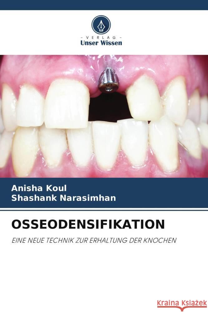 OSSEODENSIFIKATION Koul, Anisha, Narasimhan, Shashank 9786205163122 Verlag Unser Wissen - książka