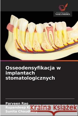 Osseodensyfikacja w implantach stomatologicznych Rao, Parveen, Samra, Rupandeep Kaur, Chaudhary, Sunita 9786209395420 Wydawnictwo Nasza Wiedza - książka
