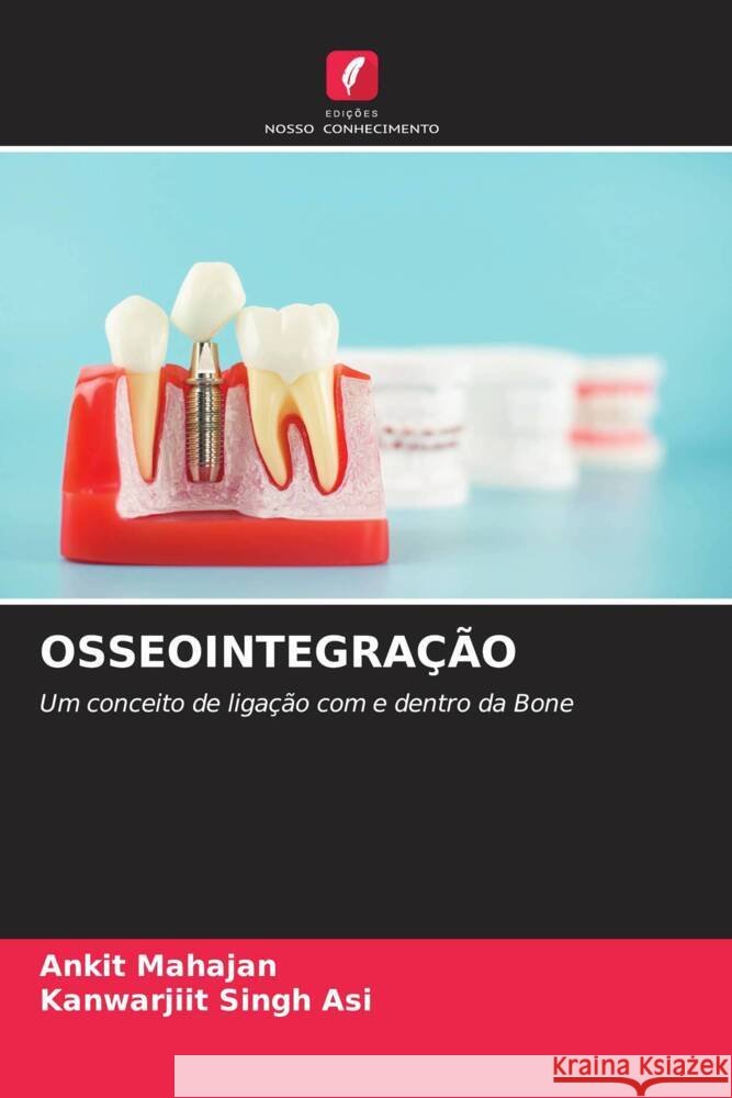 OSSEOINTEGRAÇÃO Mahajan, Ankit, Singh Asi, Kanwarjiit 9786204432014 Edições Nosso Conhecimento - książka