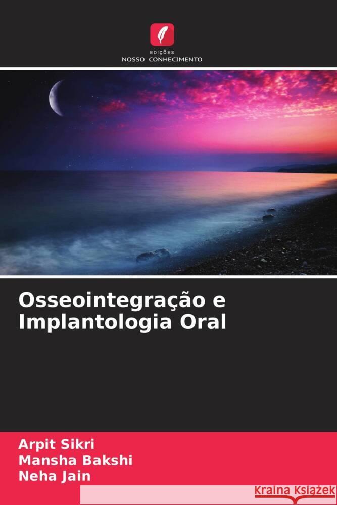 Osseointegra??o e Implantologia Oral Arpit Sikri Mansha Bakshi Neha Jain 9786207360291 Edicoes Nosso Conhecimento - książka