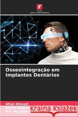 Osseointegra??o em Implantes Dent?rios Afzal Ahmad Geeta Rajput MD Mojahid Anwar 9786205678282 Edicoes Nosso Conhecimento - książka