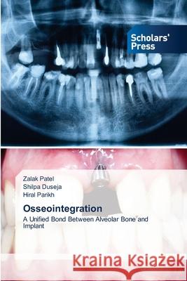 Osseointegration Zalak Patel, Shilpa Duseja, Hiral Parikh 9786138969631 Scholars' Press - książka