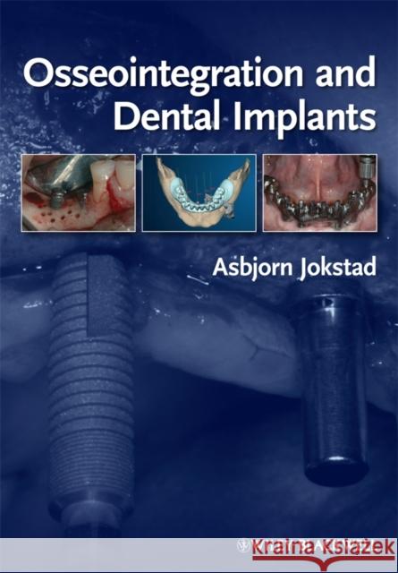 Osseointegration and Dental Implants Toronto Osseointegration Conference Revi 9780813813417 Wiley-Blackwell - książka