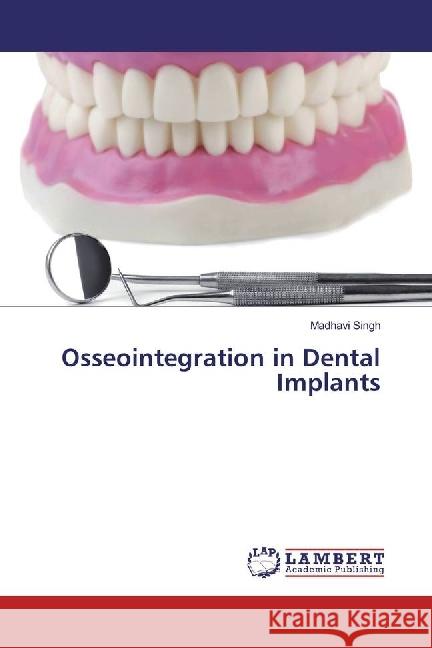 Osseointegration in Dental Implants Singh, Madhavi 9783659923517 LAP Lambert Academic Publishing - książka