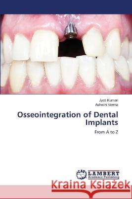 Osseointegration of Dental Implants Jyoti Kumari Ashwini Verma 9786205640739 LAP Lambert Academic Publishing - książka